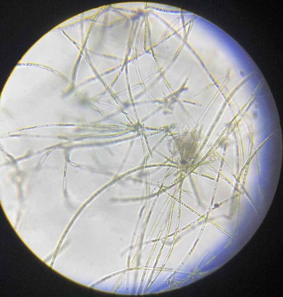 細長い藻の細胞